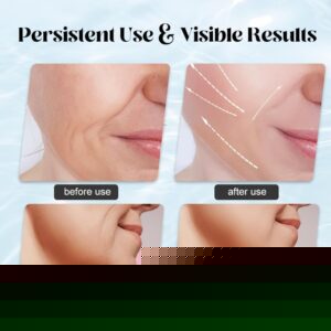 Massager for Face Lifting Facial Massagers EMS Neck Eye Massage Instrument Vibrator Microcurrents Red Light Therapy Anti Wrinkle - Random Color